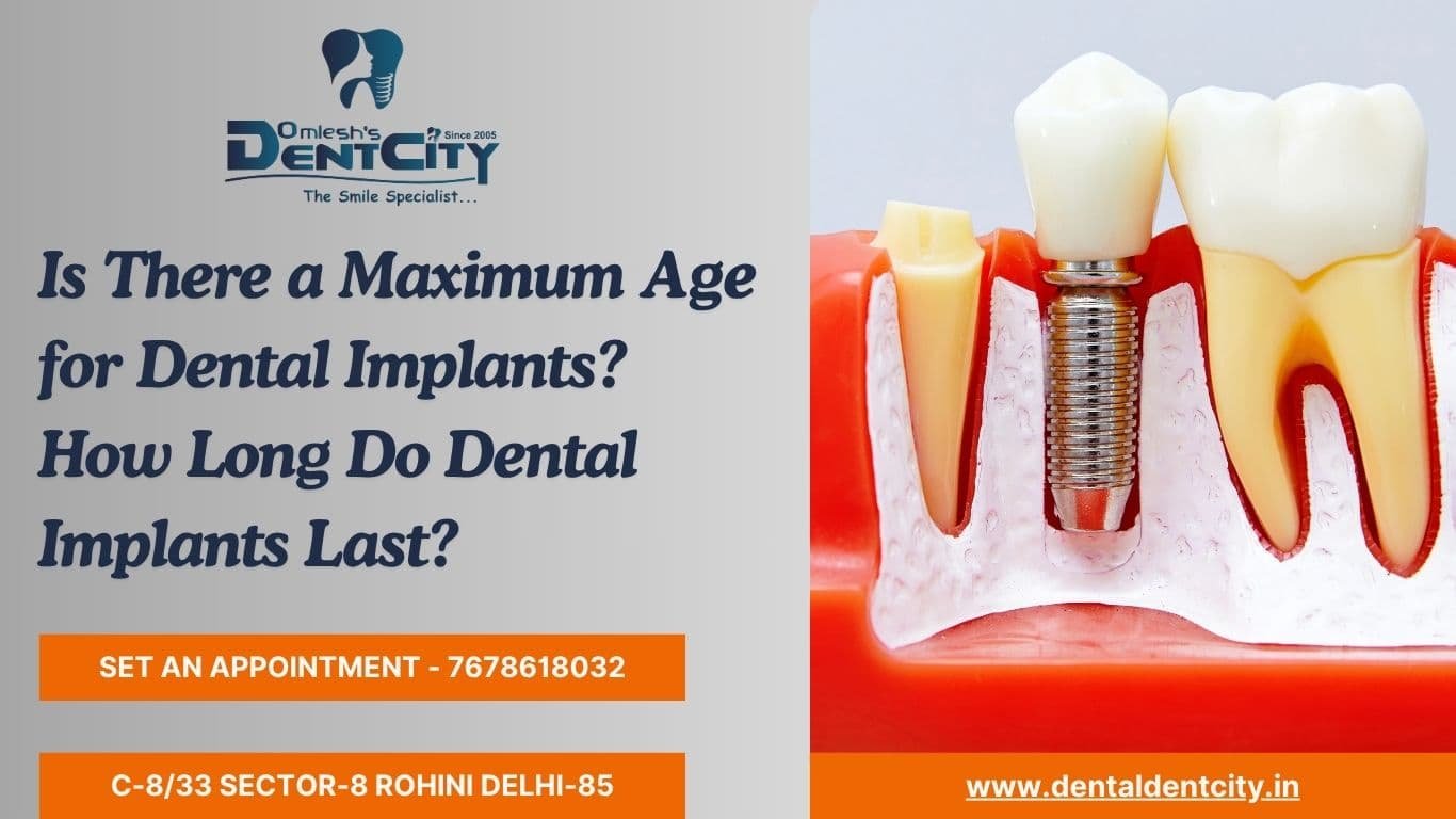 Is There a Maximum Age for Dental Implants? How Long Do Dental Implants Last?