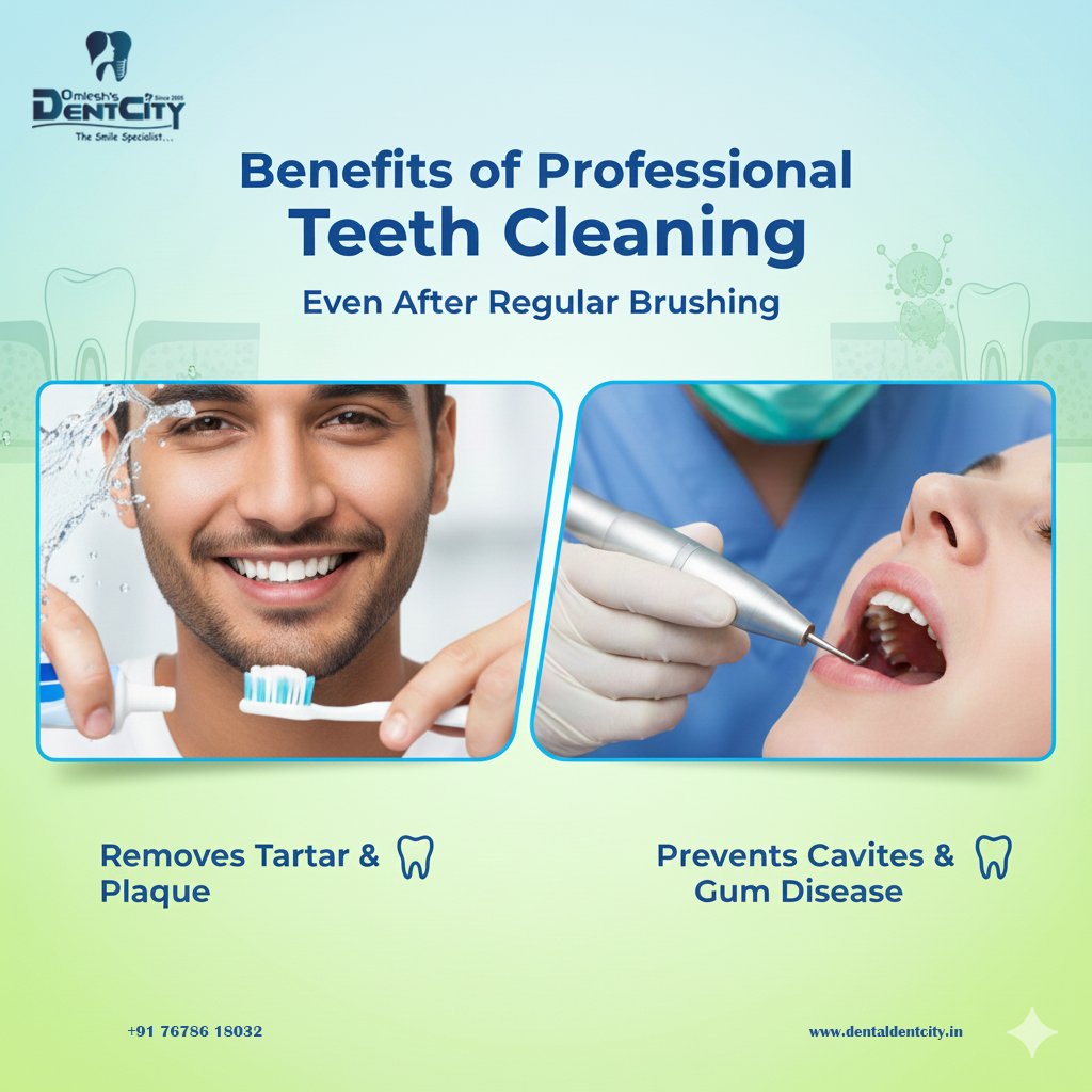 Benefits of Professional Teeth Cleaning Even After Regular Brushing