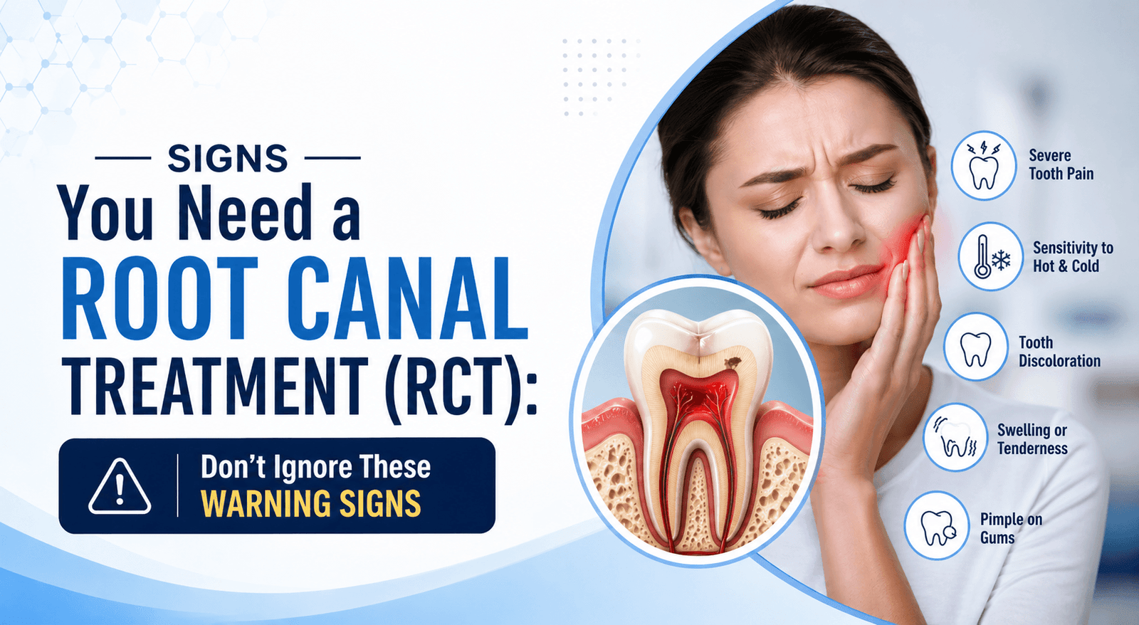 Signs You Need a Root Canal Treatment (RCT): Don’t Ignore These Warning Signs