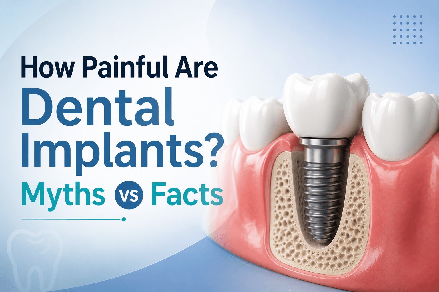 How Painful Are Dental Implants? Myths vs Facts