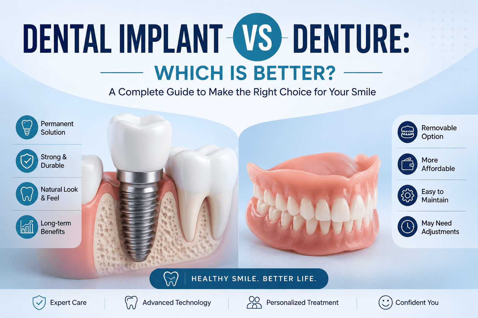 Dental Implant vs Denture: Which Is Better?