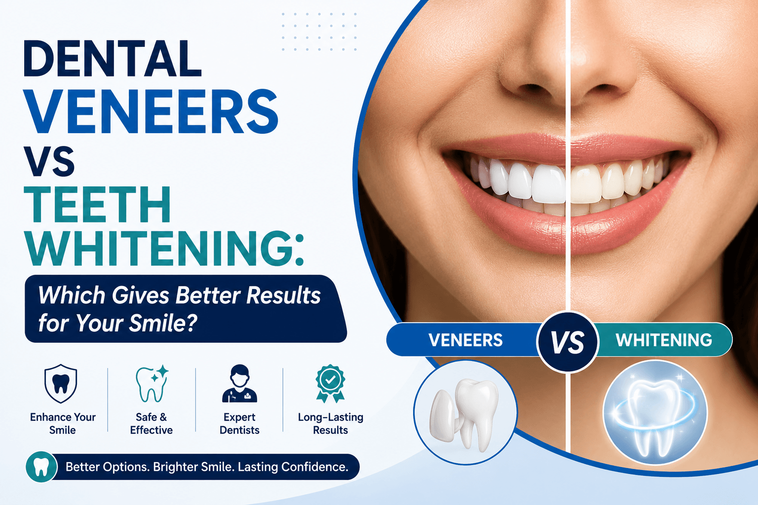 Dental Veneers vs Teeth Whitening: Which Gives Better Results for Your Smile?