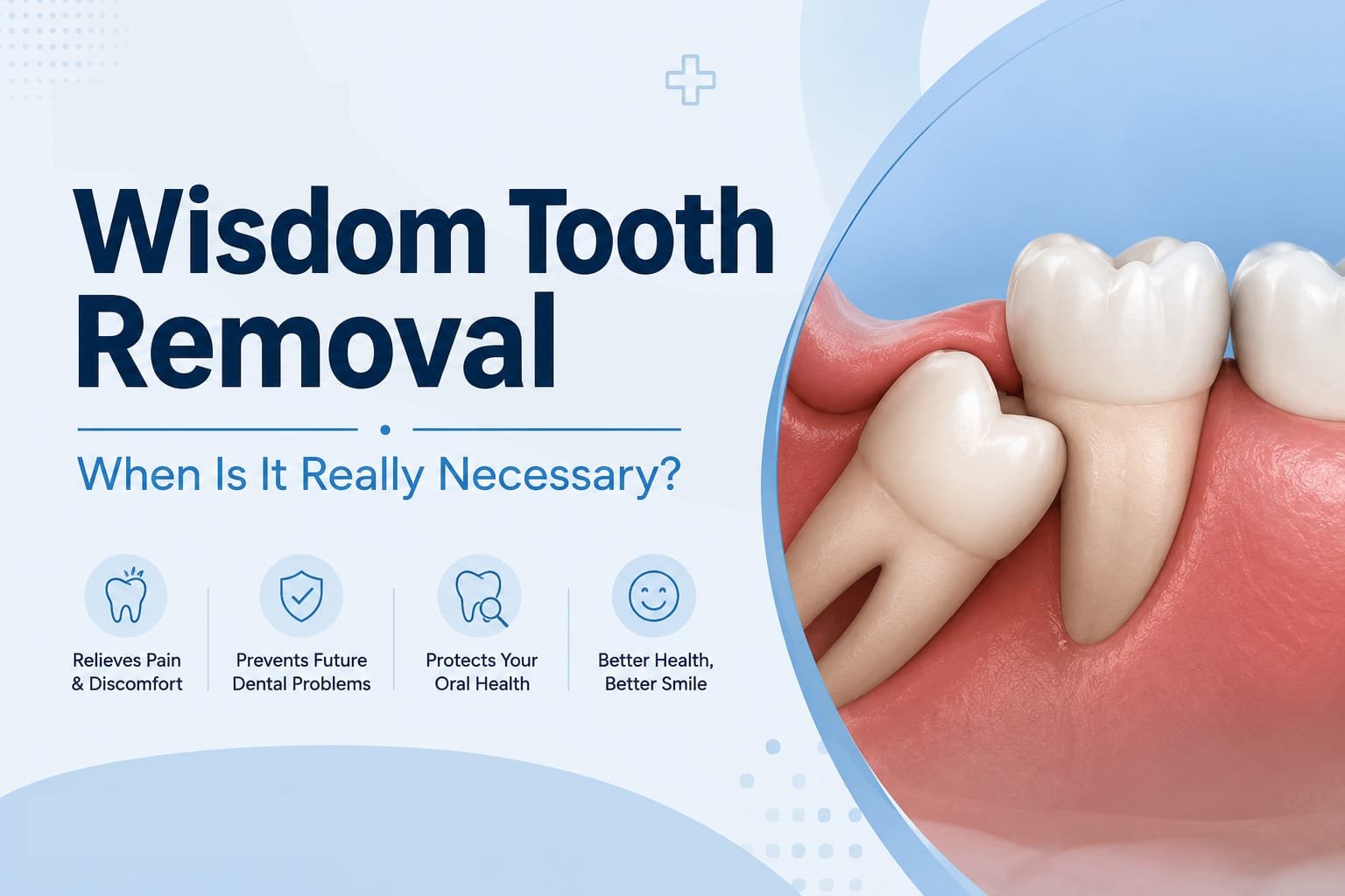 Wisdom Tooth Removal: When Is It Really Necessary?